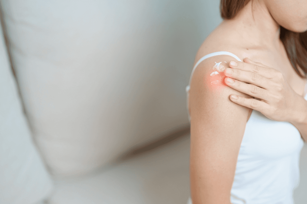 Pain Creams and Custom Compounded Pain Creams