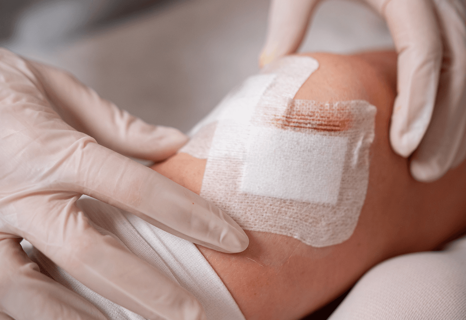 Wound Care and Skin Ulcers