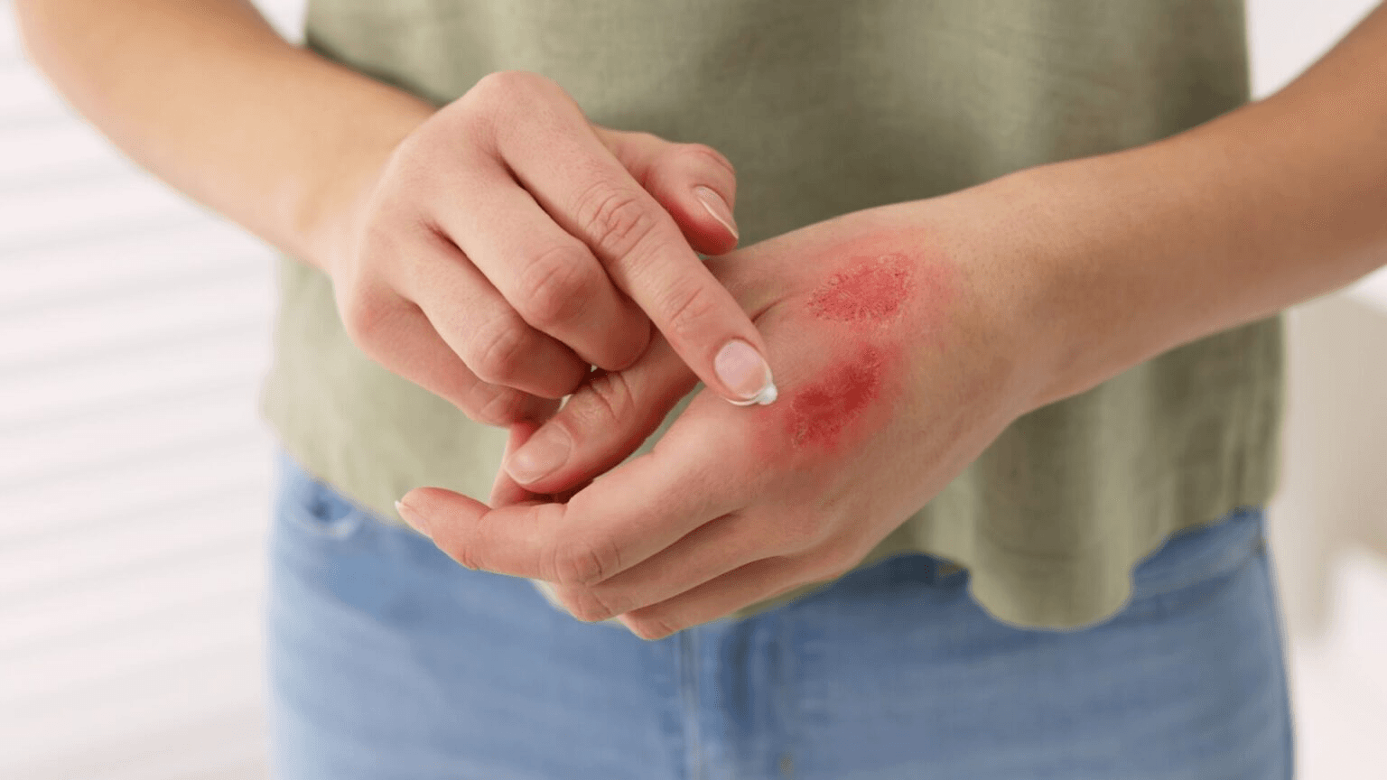 Wound Care Solutions